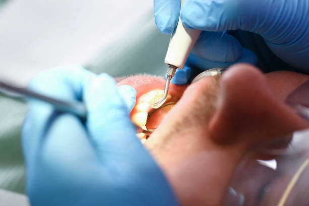 Best Cracked Tooth Emergency Dentist  in Marysville, PA