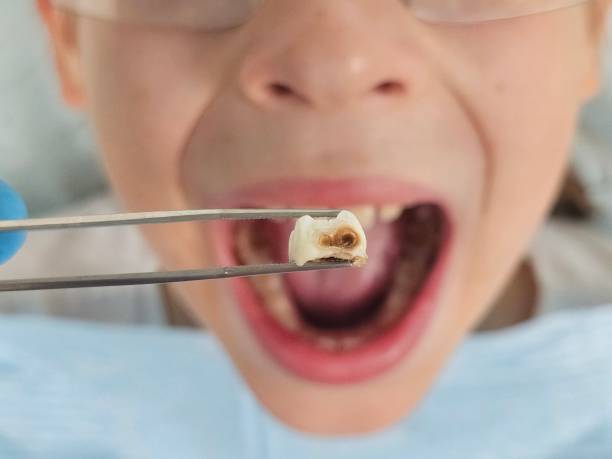 Best Broken Tooth Emergency  in Marysville, PA